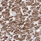Immunohistochemical staining of human heart muscle shows strong granular cytoplasmic positivity in cardiomyocytes.