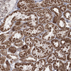Immunohistochemical staining of human kidney shows strong granular cytoplasmic positivity in cells in tubules.
