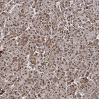 Immunohistochemical staining of human pancreas shows weak granular cytoplasmic positivity in exocrine glandular cells.