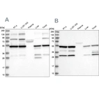 Western blot analysis using Anti-PDHX antibody HPA038484 (A) shows similar pattern to independent antibody HPA038485 (B).