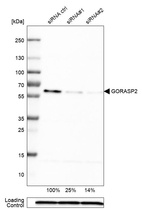 Western blot analysis in U-251MG cells transfected with control siRNA, target specific siRNA probe #1 and #2, using Anti-GORASP2 antibody. Remaining relative intensity is presented. Loading control: Anti-PPIB.