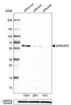 Western blot analysis in U-251MG cells transfected with control siRNA, target specific siRNA probe #1 and #2, using Anti-GORASP2 antibody. Remaining relative intensity is presented. Loading control: Anti-PPIB.