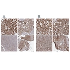 Immunohistochemical staining of human heart muscle, kidney, pancreas and skeletal muscle using Anti-PDHX antibody HPA038485 (A) shows similar protein distribution across tissues to independent antibody HPA038484 (B).