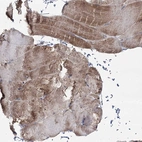 Immunohistochemical staining of human skeletal muscle shows moderate granular cytolasmic positivity in myocytes.