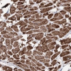 Immunohistochemical staining of human heart muscle shows strong granular cytoplasmic positivity in cardiomyocytes.