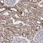 Immunohistochemical staining of human kidney shows moderate granular cytoplasmic positivity in cells in tubules.