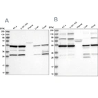 Western blot analysis using Anti-PDHX antibody HPA038485 (A) shows similar pattern to independent antibody HPA038484 (B).
