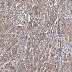 Anti-TMEM218 Antibody