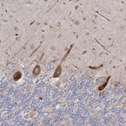 Immunohistochemical staining of human cerebellum shows moderate cytoplasmic positivity in Purkinje cells.