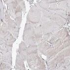 Immunohistochemical staining of human skeletal muscle shows no positivity in myocytes as expected.