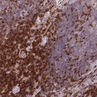 Immunohistochemical staining of human lymph node shows moderate to strong positivity.
