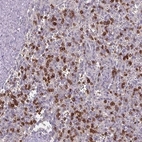 Immunohistochemical staining of human spleen shows moderate to strong positivity.