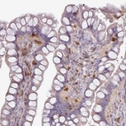 Immunohistochemical staining of human small intestine shows moderate to strong positivity in lymphoid cells.