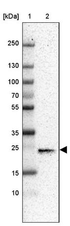 Lane 1: Marker [kDa] 250, 130, 100, 70, 55, 35, 25, 15, 10_br/_Lane 2: Human cell line MOLT-4