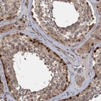 Immunohistochemical staining of human testis shows moderate to strong nuclear and cytoplasmic positivity in cells in seminiferous ducts.