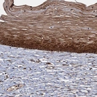 Immunohistochemical staining of human cervix shows strong nuclear positivity in squamous epithelial cells.