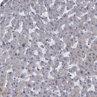 Immunohistochemical staining of human liver shows very weak cytoplasmic positivity in hepatocytes as expected.
