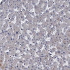 Immunohistochemical staining of human liver shows very weak cytoplasmic positivity in hepatocytes as expected.