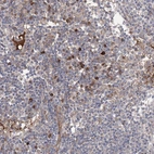 Immunohistochemical staining of human lymph node shows moderate to strong cytoplasmic positivity in lymphoid cells.