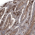 Immunohistochemical staining of human duodenum shows moderate to strong cytoplasmic positivity in lymphoid cells.