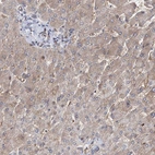 Immunohistochemical staining of human liver shows weak to moderate cytoplasmic positivity in hepatocytes.