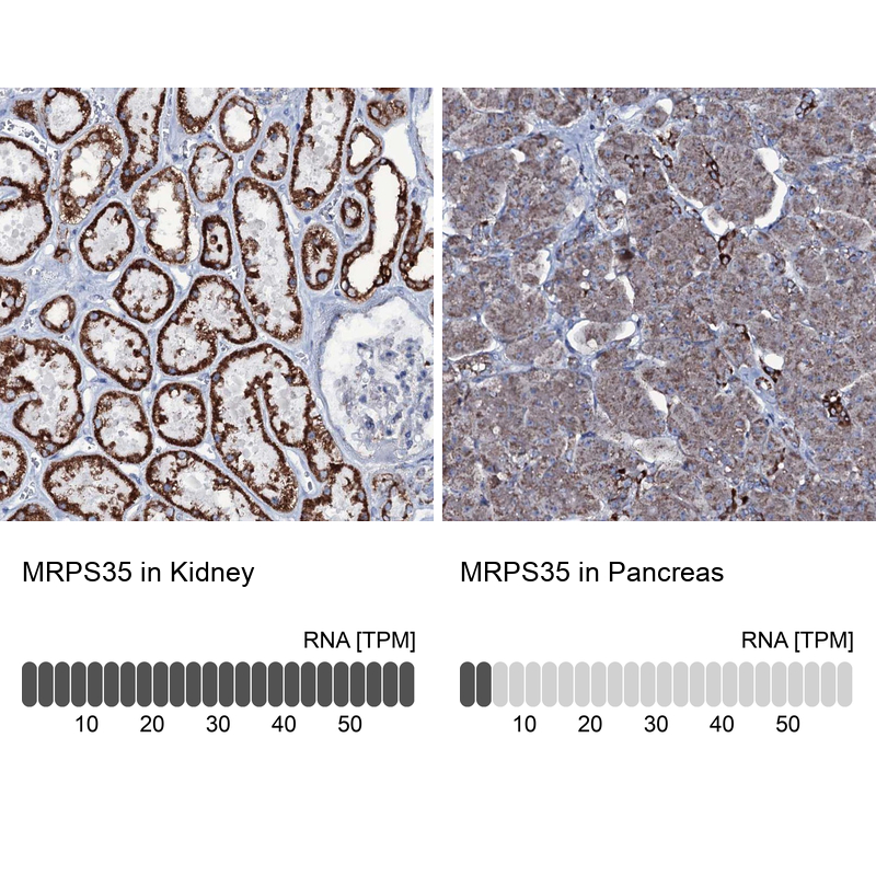 Anti-MRPS35 Antibody