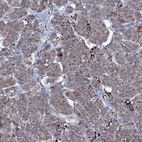 Anti-MRPS35 Antibody