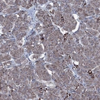 Immunohistochemical staining of human pancreas shows low expression as expected.