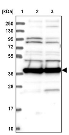 Lane 1: Marker [kDa] 250, 130, 95, 72, 55, 36, 28, 17, 10_br/_Lane 2: Human cell line RT-4_br/_Lane 3: Human cell line U-251MG sp