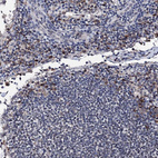 Immunohistochemical staining of human lymph node shows strong nuclear positivity in germinal center cells and non- germinal center cells.