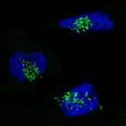 Immunofluorescence staining in U251 cell line with Anti-GORASP2 monoclonal antibody, showing specific staining of the golgi apparatus in green. Microtubule- and nuclear probes are visualized in red and blue respectively (where available).