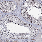 Immunohistochemical staining of human testis shows strong nuclear positivity in cells in seminiferous ducts.