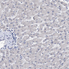 Immunohistochemical staining of human liver shows no positivity in hepatocytes as expected.