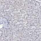 Immunohistochemical staining of human liver shows no positivity in hepatocytes as expected.