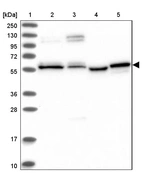 Lane 1: Marker [kDa] 250, 130, 95, 72, 55, 36, 28, 17, 10_br/_Lane 2: Human cell line RT-4_br/_Lane 3: Human cell line U-251MG sp_br/_Lane 4: Human plasma (IgG/HSA depleted)_br/_Lane 5: Human liver tissue