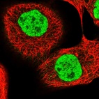 Immunofluorescent staining of human cell line A-431 shows localization to nucleoplasm.