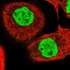Immunofluorescent staining of human cell line A-431 shows localization to nucleoplasm.