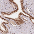 Anti-CCDC65 Antibody