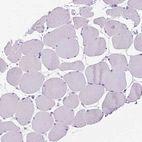Immunohistochemical staining of human skeletal muscle shows no cytoplasmic positivity as expected.
