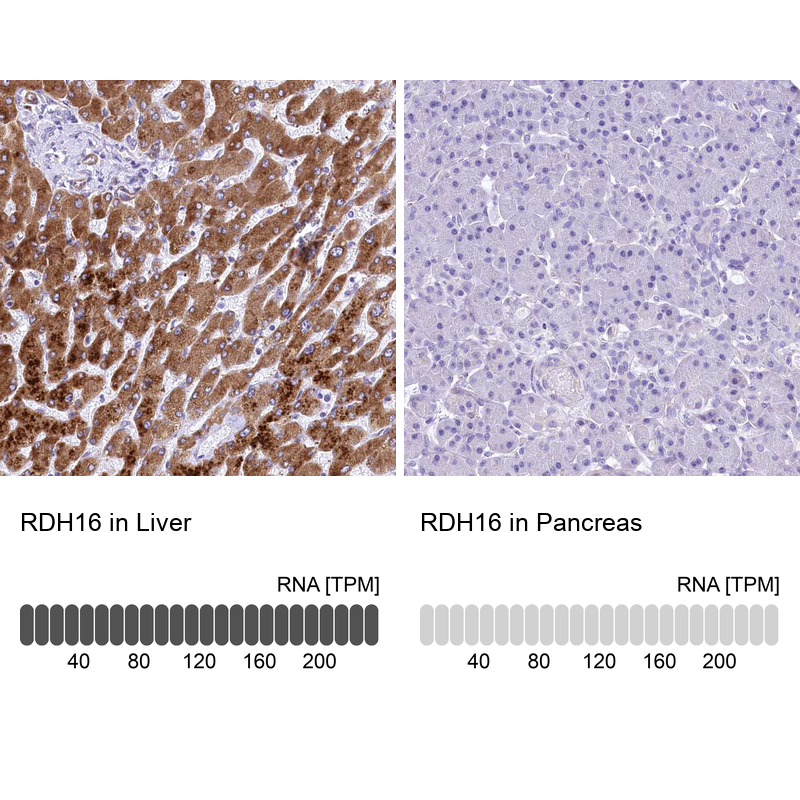 Anti-RDH16 Antibody