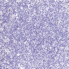 Anti-RDH16 Antibody