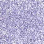 Immunohistochemical staining of human lymph node shows no positivity as expected.