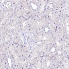 Immunohistochemical staining of human kidney shows no positivity in cells in tubules as expected.