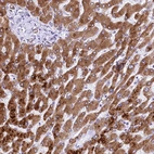 Immunohistochemical staining of human liver shows strong granular cytoplasmic positivity in hepatocytes.