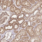 Anti-APBB1 Antibody