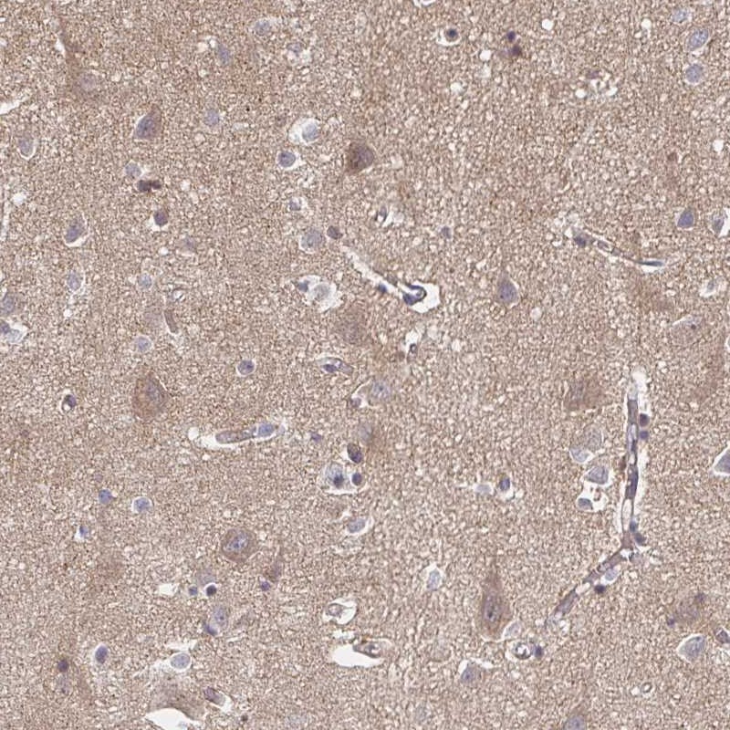 Anti-APBB1 Antibody