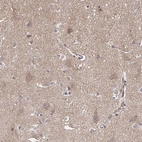 Anti-APBB1 Antibody