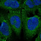 Immunofluorescent staining of human cell line HEK 293 shows localization to plasma membrane.