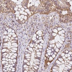 Anti-NADSYN1 Antibody