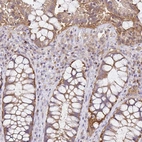 Anti-NADSYN1 Antibody